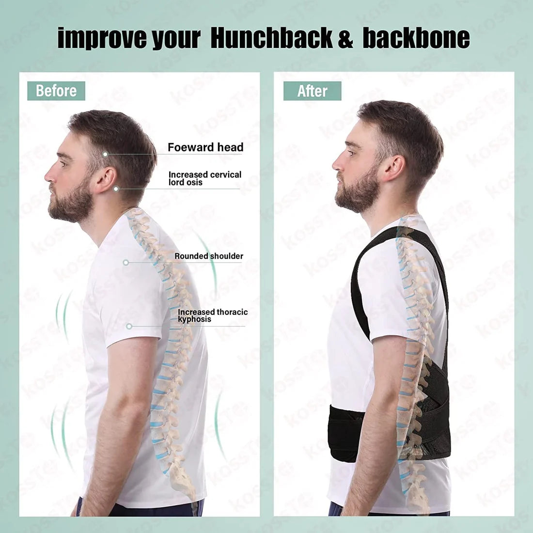 Posture Corrector Belt-Adjustable
